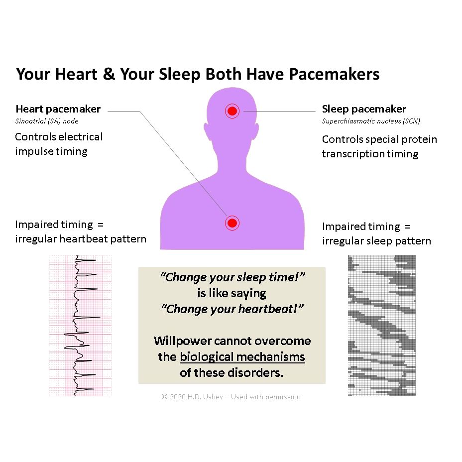 An image of an irregular heartbeat and an irregular sleep pattern with the caption: "Change your sleep time is like saying change your heartbeat. Willpower cannot overcome the biological mechanisms of these disorders."